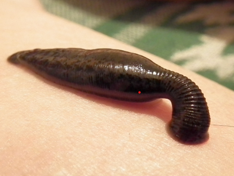 Leczenie pijawką lekarską- hirudoterapia